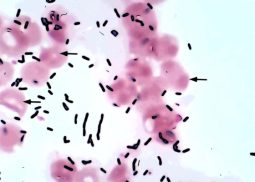 Listeria in alimenti da cuocere